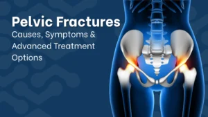 Pelvic Fractures
