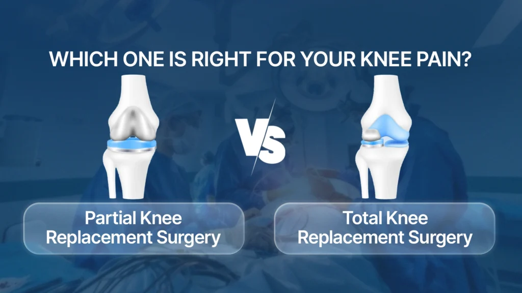 Partial vs Total Knee Replacement: Which One Is Right for Your Knee Pain?