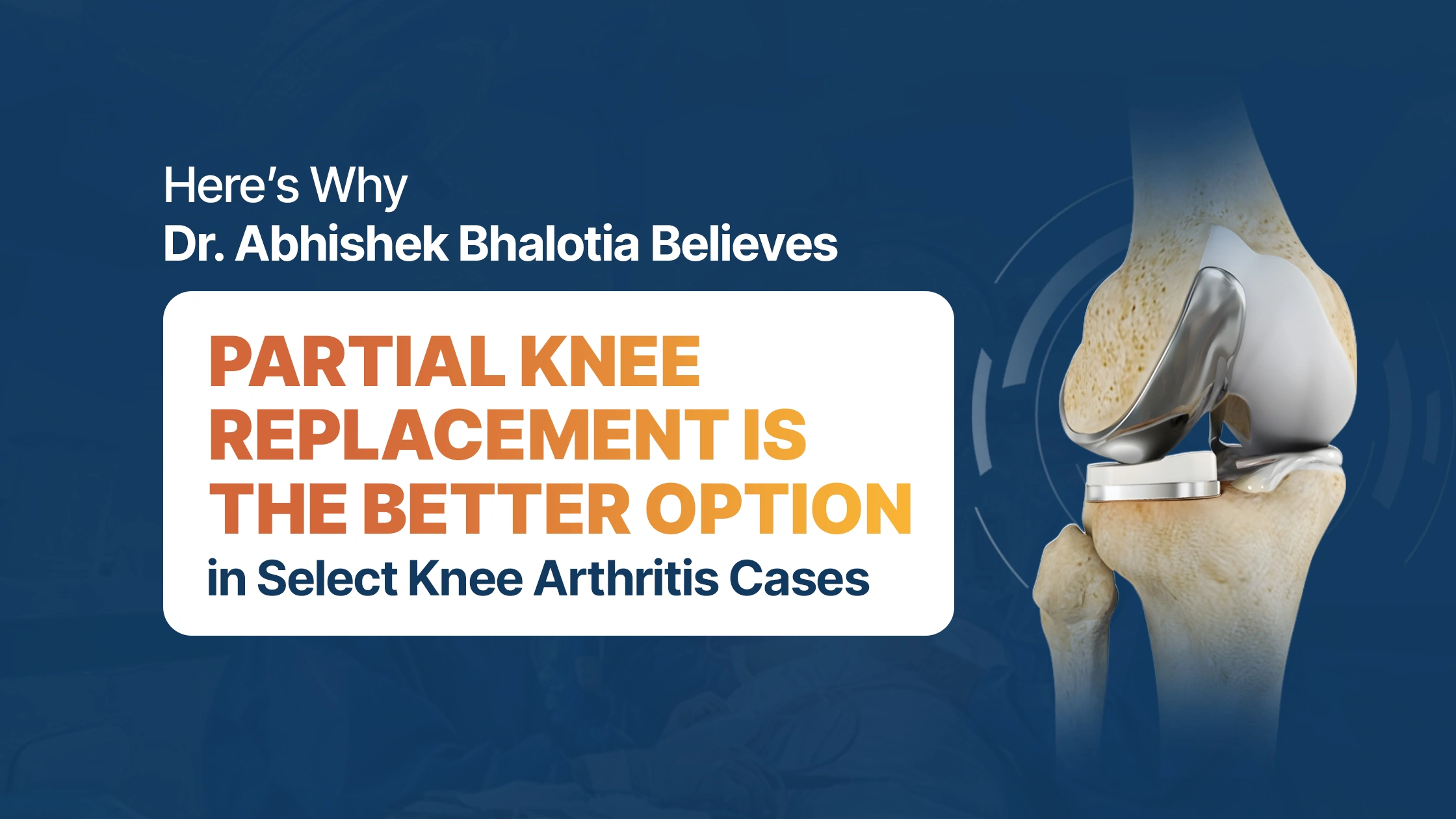 Here’s Why Dr. Abhishek Bhalotia Believes Partial Knee Replacement Is the Better Option in Select Knee Arthritis Cases